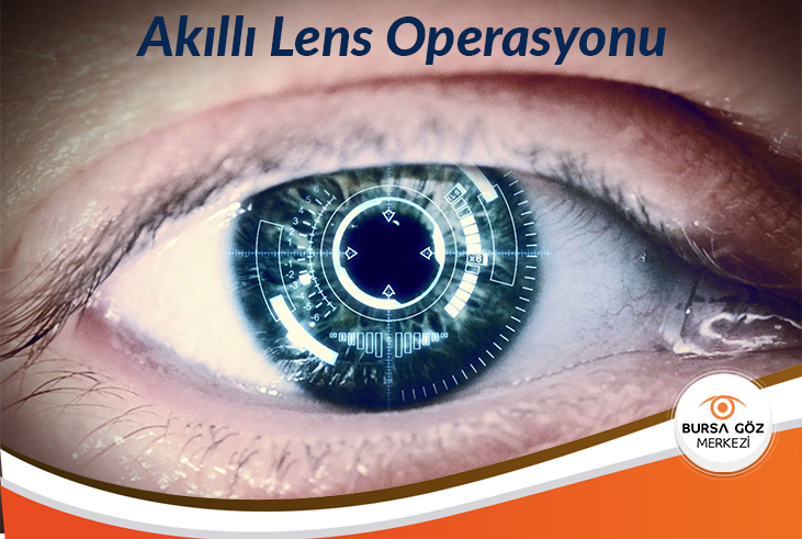 Akıllı Lens Operasyonu Nedir? Nasıl Uygulanır?